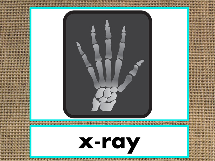 Letter X Alphabet PowerPoint Fun & Colorful Words w/Pictures (Expandable)