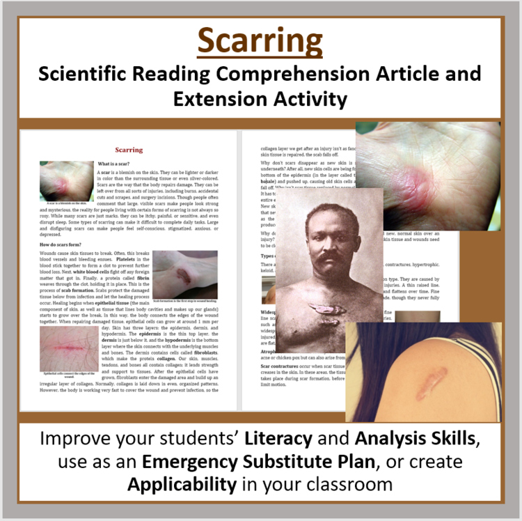 What is Scarring and What Causes it? Reading - Grade 8 and Up | Scar, Treatment