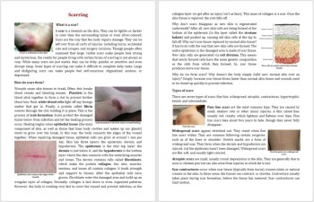 What is Scarring and What Causes it? Reading - Grade 8 and Up | Scar, Treatment, image 2