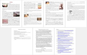 What is Scarring and What Causes it? Reading - Grade 8 and Up | Scar, Treatment, image 3