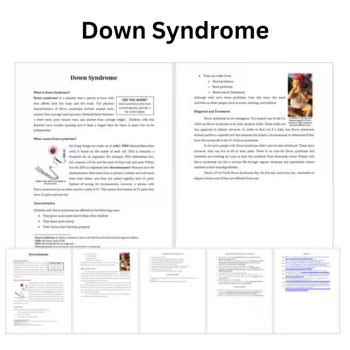 Down Syndrome Reading Comprehension Passage & Questions | 6th, 7th, 8th Grade, image 2