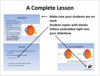 The Eye 5E Lesson Bundle | Eye Anatomy, Vision Problems, Laser Eye Surgery, image 3