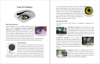 Laser Eye Surgery Reading Comprehension Passage and Questions | Grade 8 and Up, image 2
