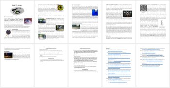 Laser Eye Surgery Reading Comprehension Passage and Questions | Grade 8 and Up, image 3