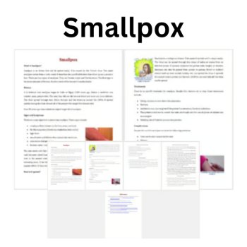 Smallpox Reading Comprehension Passage and Questions | 6th, 7th, 8th Grade, image 2