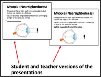 The Human Eye Lesson | The Human Visual System Lesson | High School Optics, image 3