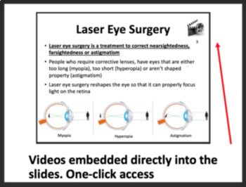 The Human Eye Lesson | The Human Visual System Lesson | High School Optics, image 4